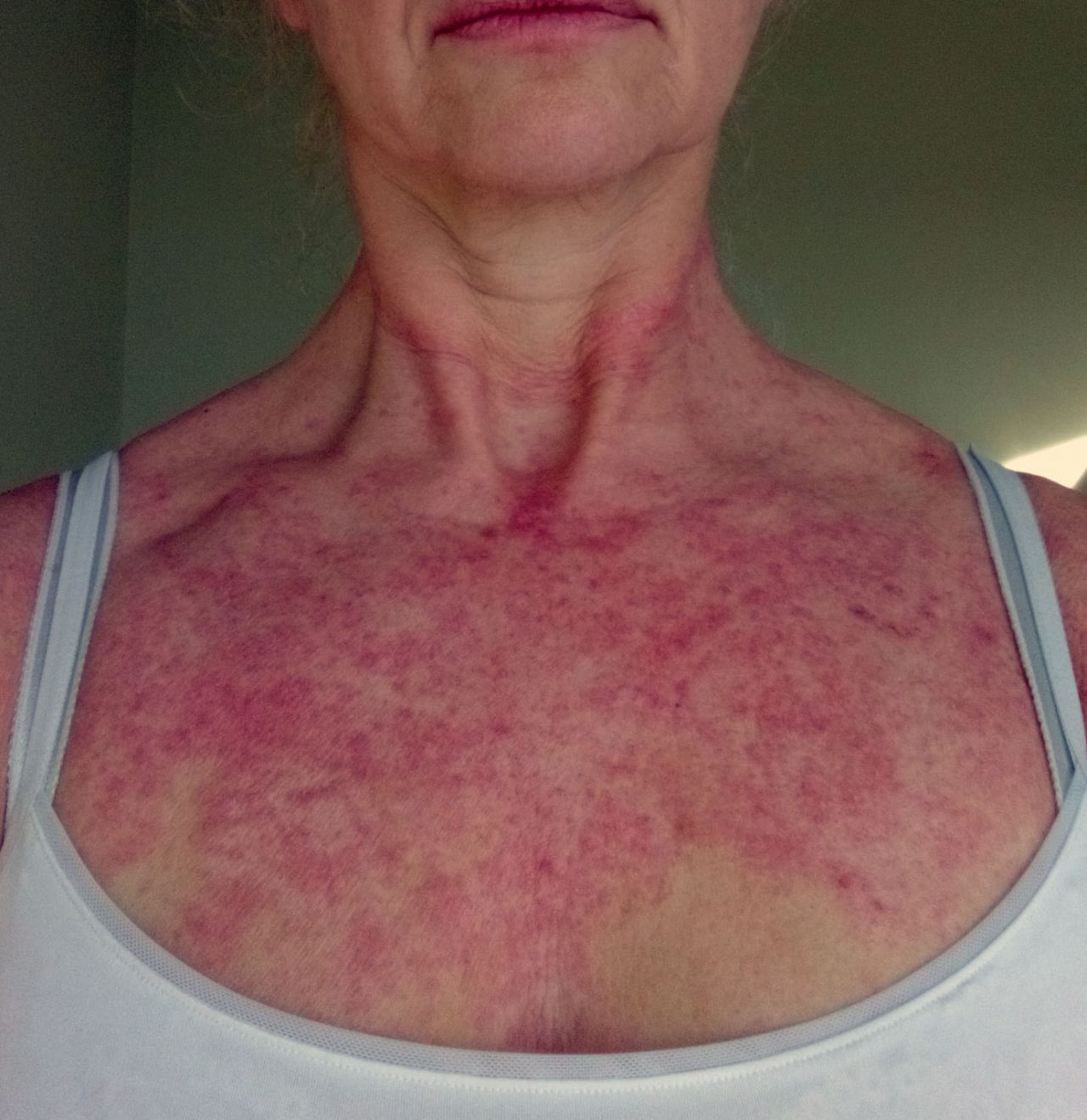 discovering-menopause-itchy-skin-the-coddiwomple-lady